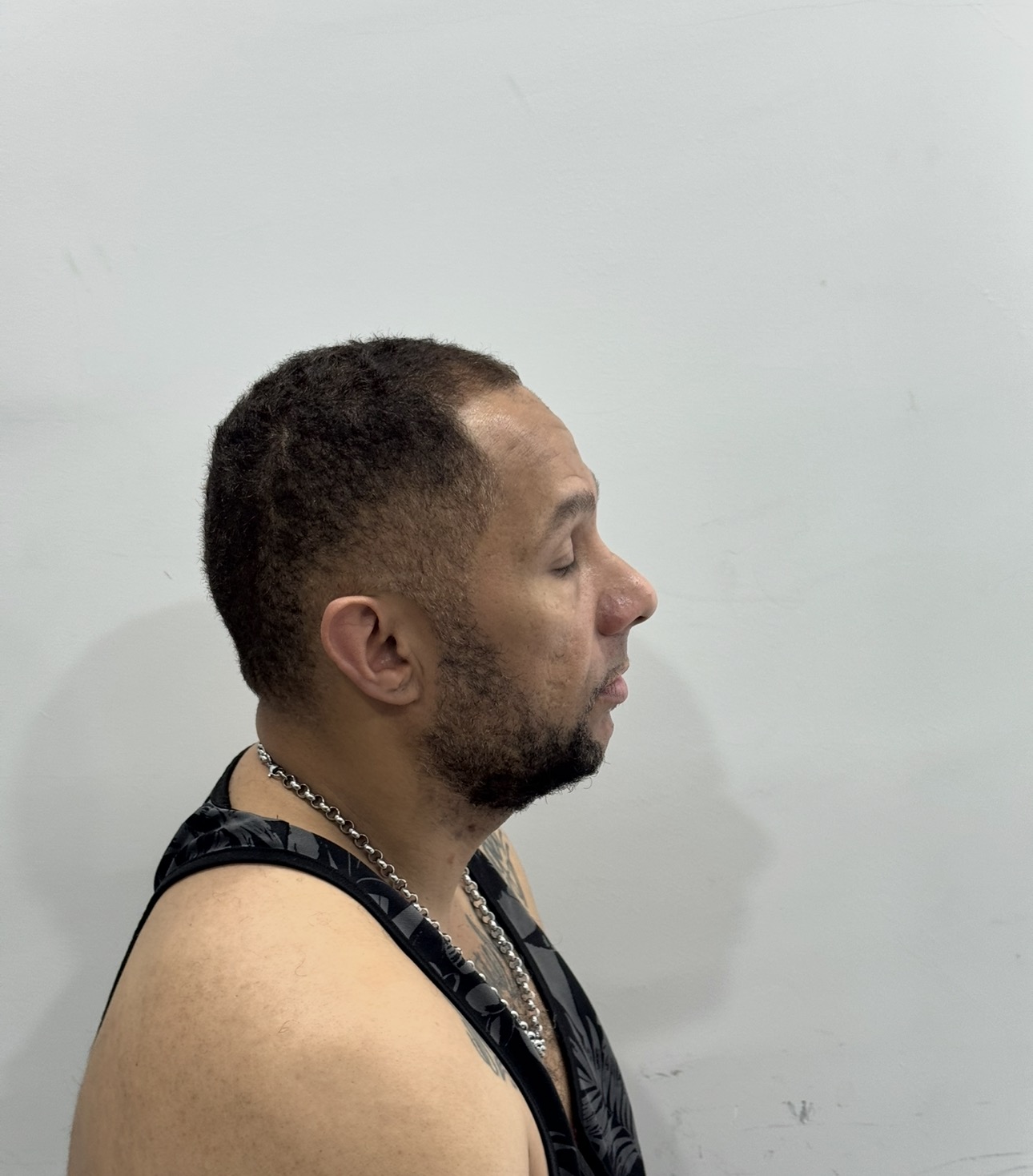 Afro Saç Ekimi Antalya görsel 1