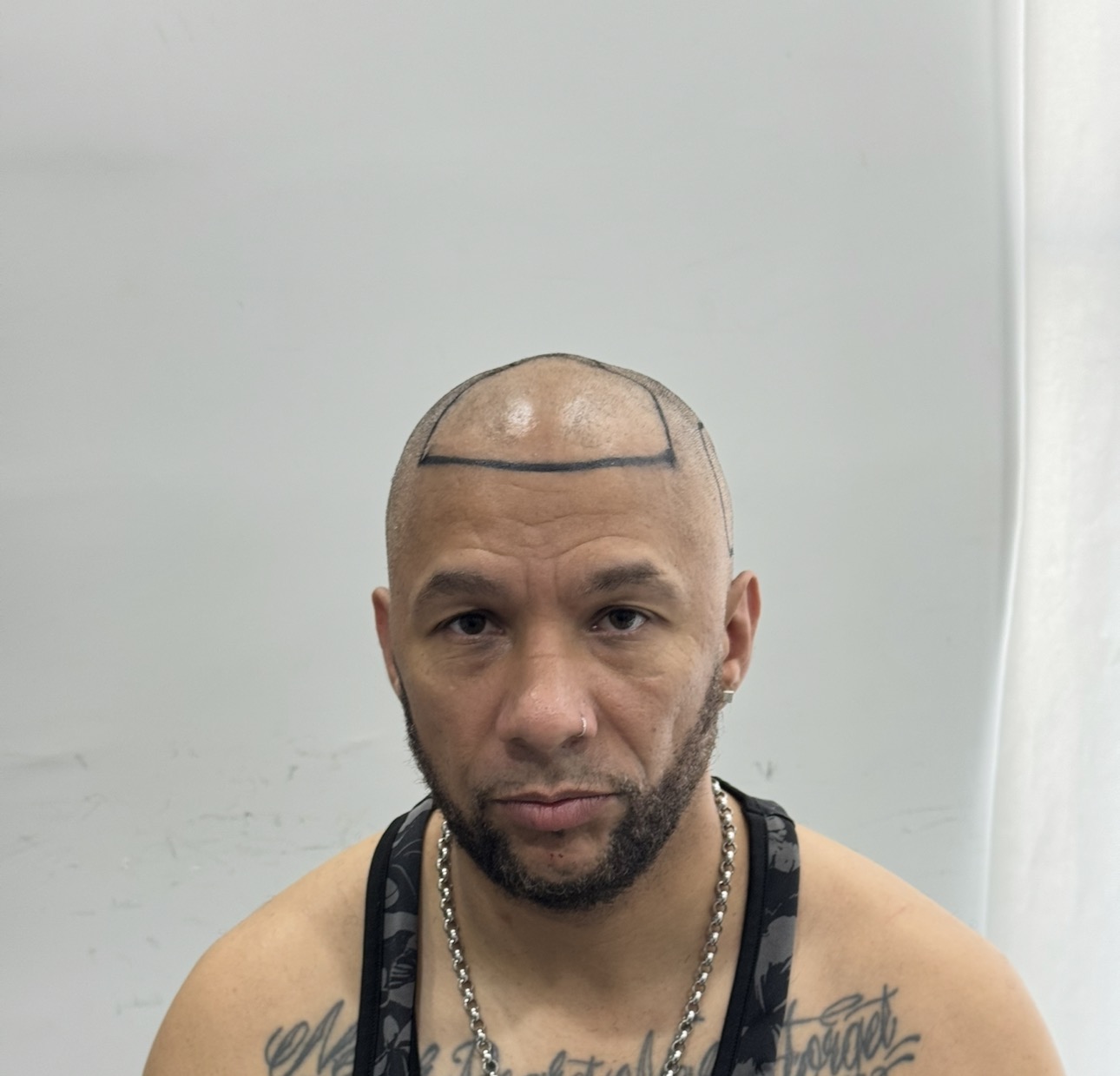 Afro Saç Ekimi Antalya görsel 4