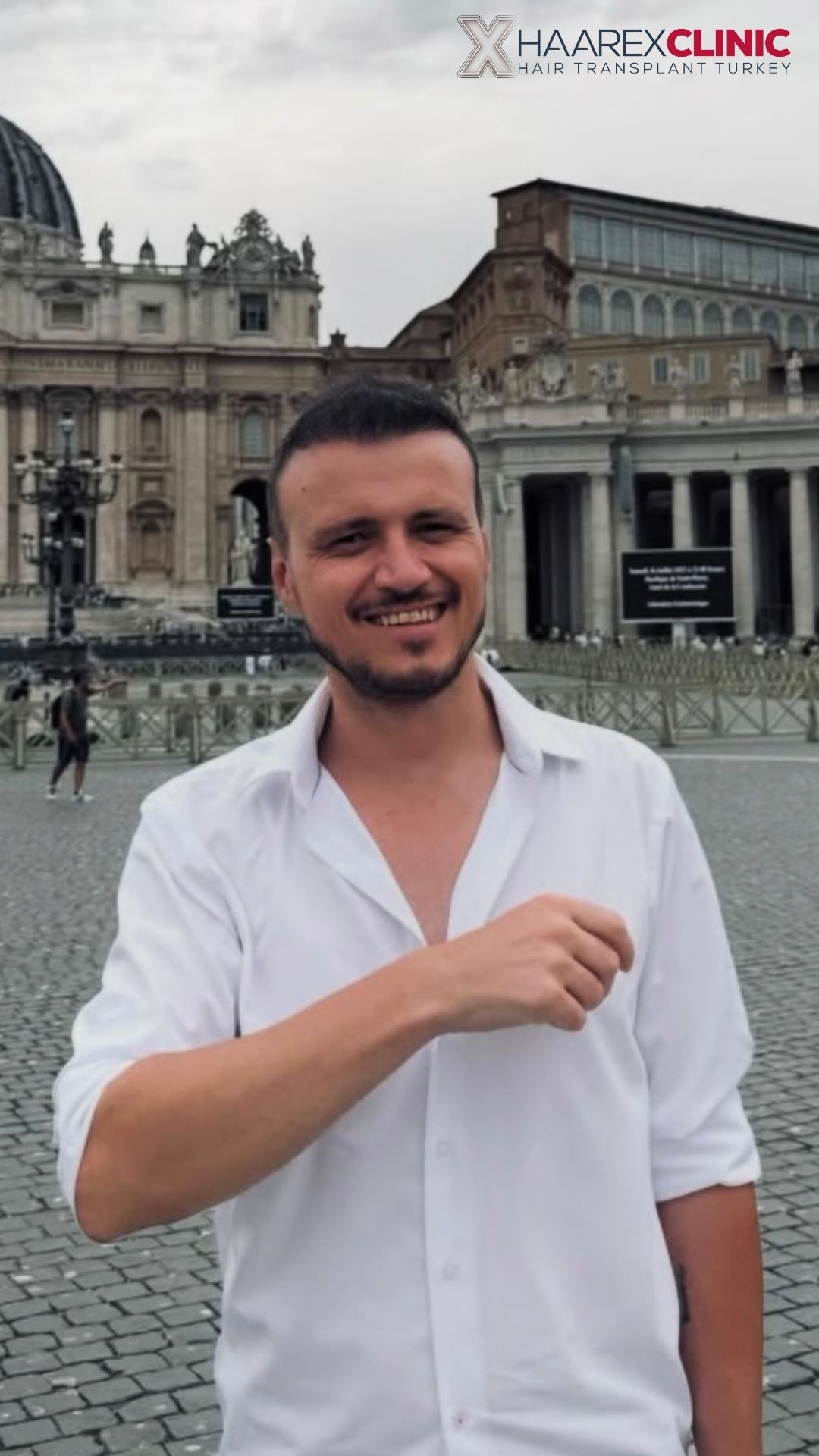 Göktan Al Haartransplantation nachher